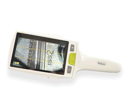 Cam-BETA - Digital inspection and portable magnification